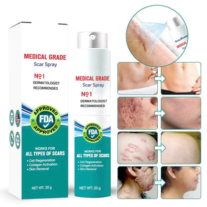 ❤️Advanced Scar Spray For All Types of Scars - For example Acne Scars, Surgical Scars and Stretch Marks ⚡️⚡️⚡️